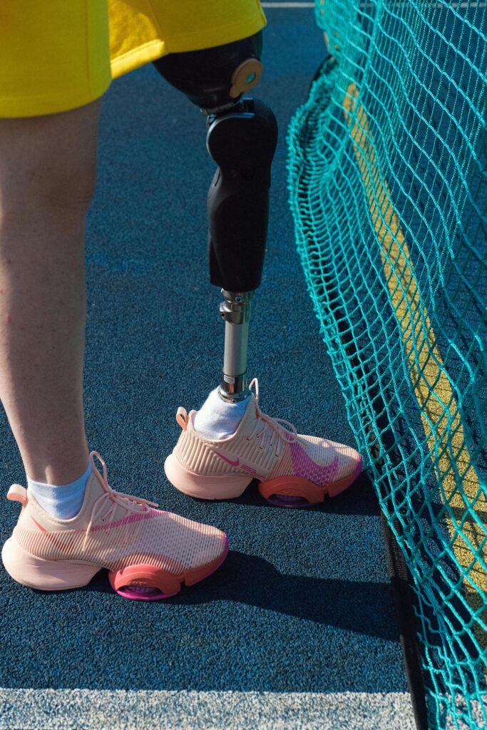Close-up of a prosthetic leg in athletic shoes next to a tennis net outdoors.